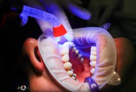 Zajmujemy się kompleksową higieną jamy ustnej, dbając o zdrowie zębów i dziąseł naszych pacjentów.